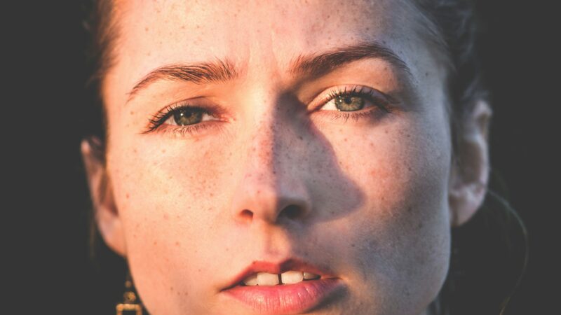 A woman who is wondering for botox treatment